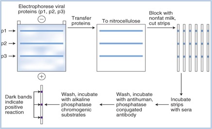 Pada metode Western Blot, dari sampel darah seseorang virus HIV dapat diketahui keberadaannya. Protein virus diperoleh dari elektroforesis. Setelah protein ditransfer ke nitroselulosa, serta melalui beberapa tahap pencucian, akan muncul band (garis-garis) di tengah substrat yang menunjukkan bagian tertentu dari HIV-1. Jika sampel darah seseorang menunjukkan satu atau beberapa band yang sama persis dengan posisi band HIV-1, itu artinya yang bersangkutan positif HIV-1.