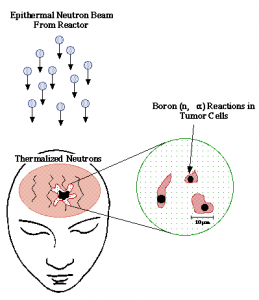 Prinsip dasar BNCT untuk terapi kanker otak