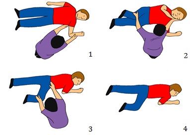 Ilustrasi recovery position. Penolong perlu memastikan pasien kondisi gawat darurat dalam posisi no. 4.