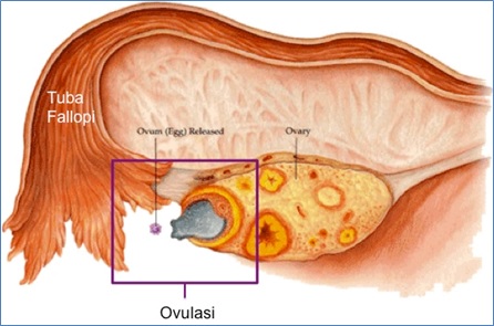   Gambar proses ovulasi sel telur yang telah matang.Sumber gambar: http://tryingtoconceive.com/ovulation