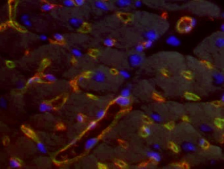 Pewarnaan jaringan jantung dengan menggunakan immunofluorescence. Warna kuning mengindikasikan protein FABP4/5 (merah) terekspresi bersama dengan pembuluh darah (hijau). Warna biru adalah inti sel.