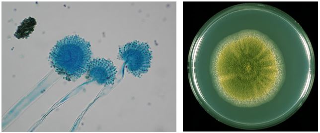 Gambar kiri: Aspergillus flavus (diambil dari labmed.ucsf.edu). Gambar kanan: Koloni A. flavus (diambil dari pfdb.net)