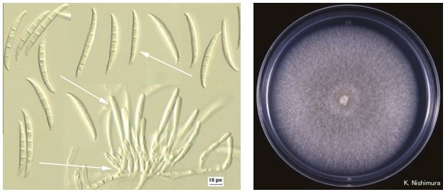 Gambar kiri: Fusarium sp. (diambil dari apsnet.org). Gambar kanan: Koloni Fusarium sp. (diambil dari pf.chiba-u.ac.jp)