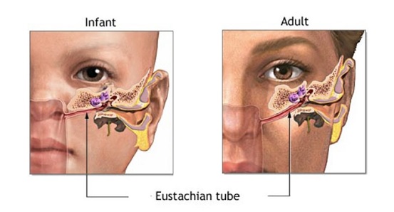 Letak tuba eustachius pada anak dan dewasa. Sumber: http://www.ent-surgery.com.au/the-eustachian-tube/