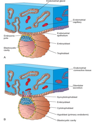  Proses adhesi dan invasi dari blastocyst. A) Hari ke-6 saat blastocyst sudah mulai menempel pada endometrium. B) Hari ke-7 saat embrio sudah menginvasi endometrium. (Sumber gambar: Moore & Persaud, The Developing Human: Clinically Oriented Embryology 7th ed).