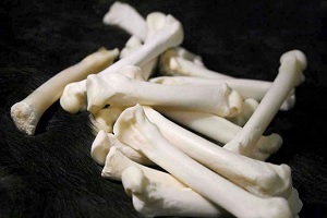 Hidroksiapatit: Material Penyusun Tulang Manusia