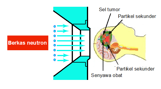 Diagram proses Neutron Capture Therapy (sumber: http://www.jaea.go.jp/jaeri/english/press/991025/fig03.html).