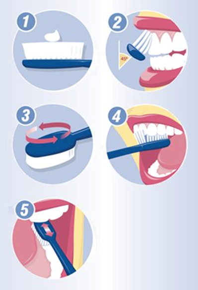 Ilustrasi cara menyikat gigi. Sumber gambar: dhsv.org.au
